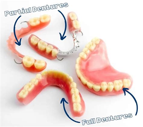 Veneers vs dentures | Hummingbird Dental | Voted Top Choice Richmond ...