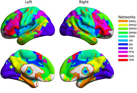 Decreased Inter Hemispheric Interactions But Increased Intra