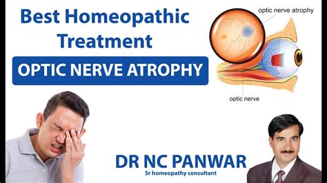 Optic nerve treatment in homeopathy by Dr N C Panwar - YouTube