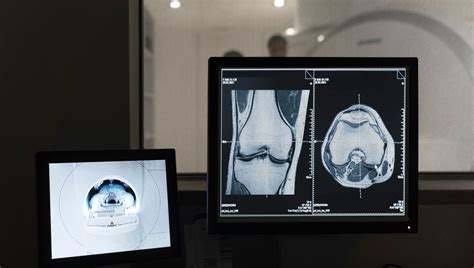 Lesiones Deportivas Diagn Stico Y Tratamiento Con Imagenolog A