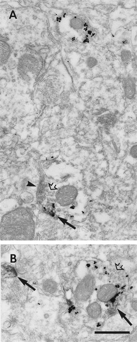 Electron Micrographs Illustrating D 1 In The Axons Of Interneurons A