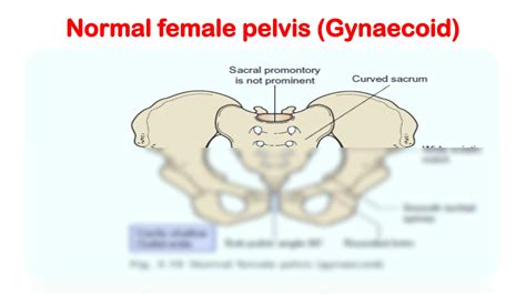 SOLUTION Bony Pelvis Lesson 3b Studypool