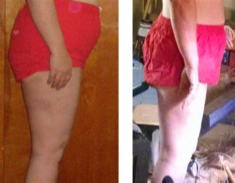 Leg photos before and after — MyFitnessPal.com