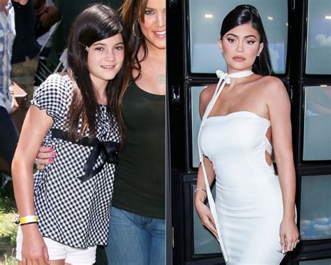 Kylie Jenner Before And After: Has She Had Work Done? — Photos ...