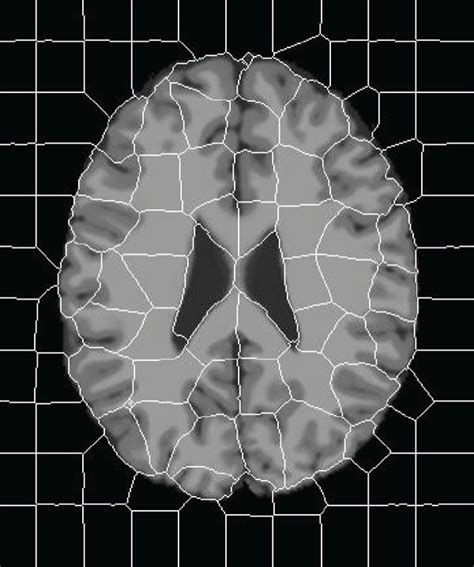 The Superpixel Segmentation Result Of Turbo Download Scientific Diagram