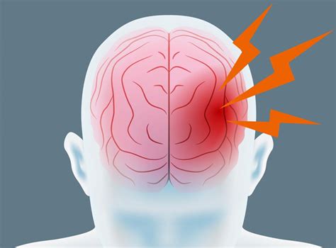 Hemorrhagic Stroke - Symptoms & Treatment at IBS Hospital