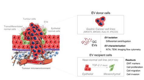 Ijms Free Full Text Gastric Cancer Extracellular Vesicles Tune The