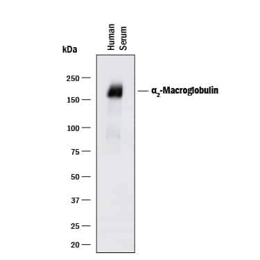 alpha 2-Macroglobulin Antibody [Unconjugated] (AF1938): Novus Biologicals