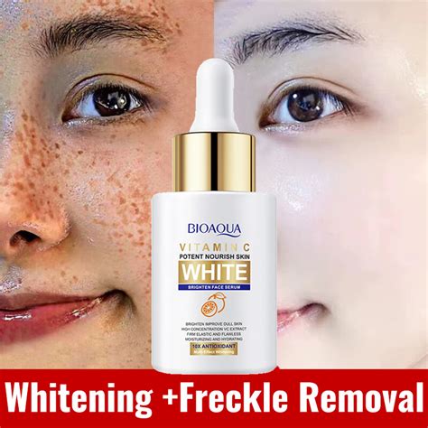 Vitamin C Whitening Serum Melasma Serum Remover Melasma And Pekas