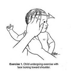 Torticollis Exercises Handout