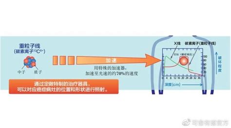 日本 “重离子治疗权威医院” —群马大学重离子医学中心