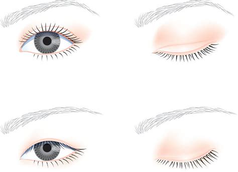 4500 Eyelid Stock Illustrations Royalty Free Vector Graphics And Clip