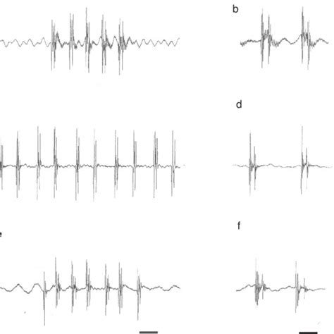 Oscillograms Of Agonistic Croaks And Details Of Double Pulses Of