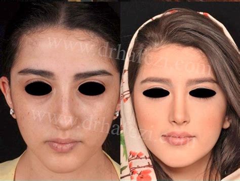 Persian Women Nose