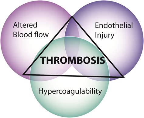 Virchows Triad Eclinpath