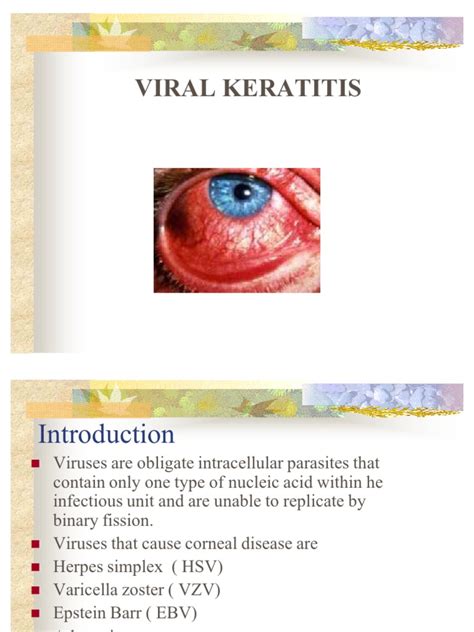 Viral Keratitis | Viral Diseases | Microbiology