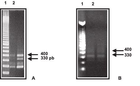 Amplificación Por Pcr De Las Regiones Intergénicas Espaciadoras Del 16