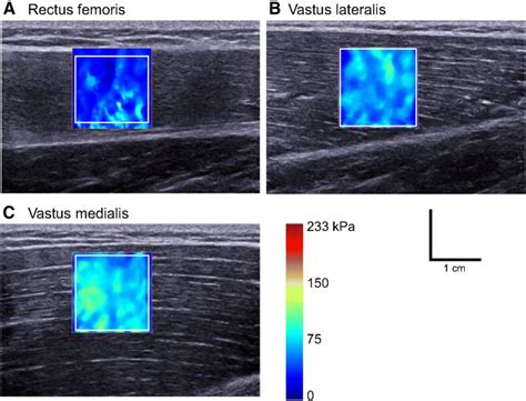 Shear Wave Elastography Typical Maps Of Shear Elastic Modulus The