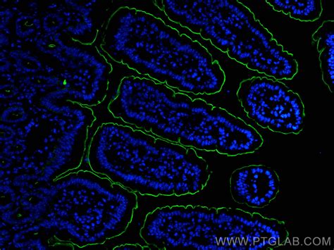 Villin antibody 16488 1 AP Proteintech 武汉三鹰生物技术有限公司