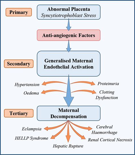 The Role Of Angiogenic Factors In The Management Of Preeclampsia