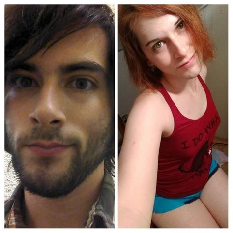 Me MtF 22 Two Years Prior And 10 Months In Gosh I Love Estrogen