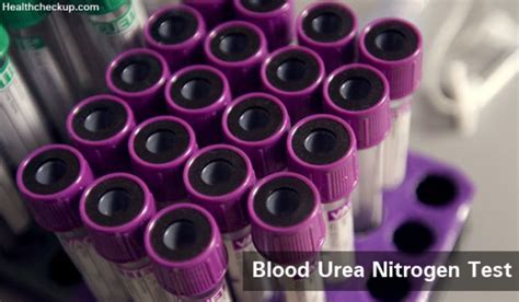 Blood Urea Nitrogen Test Preparation and Results | Symptoms of BUN