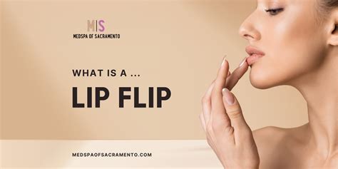 What is a Lip Flip? Lip Flip Guide for Sacramento | Procedure, Cost and ...