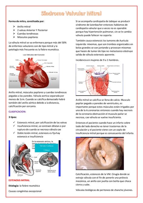 Fisiopatología De La Estenosis De La Válvula Mitral