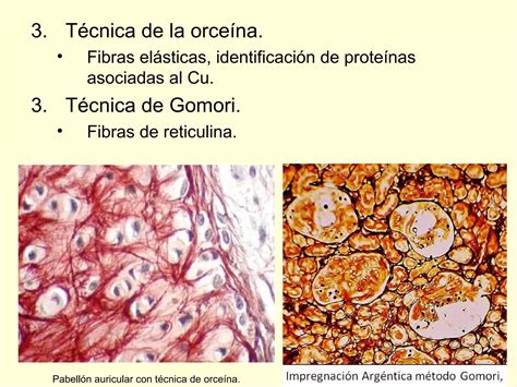 Principales tinciones en el laboratorio de anatomía patológica PPT