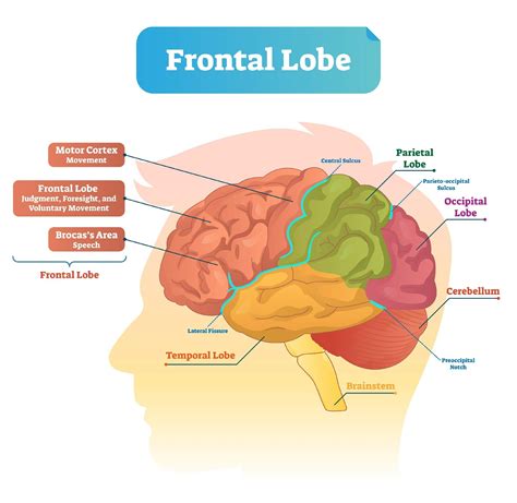 Aphasia: Types, Causes, Symptoms Treatment, 40% OFF