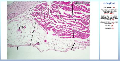 Histologia Pericardio 924 The Best Porn Website