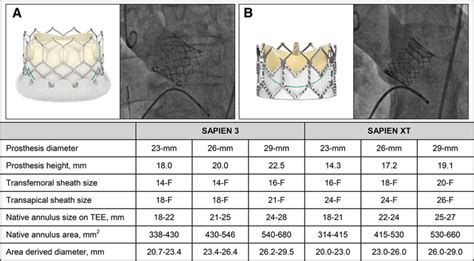 Transcatheter Aortic Valve Implantation With The New Balloon Expandable