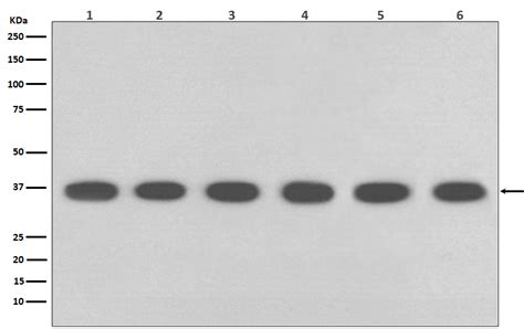 GAPDH Mouse Monoclonal Antibody | ABP Biosciences