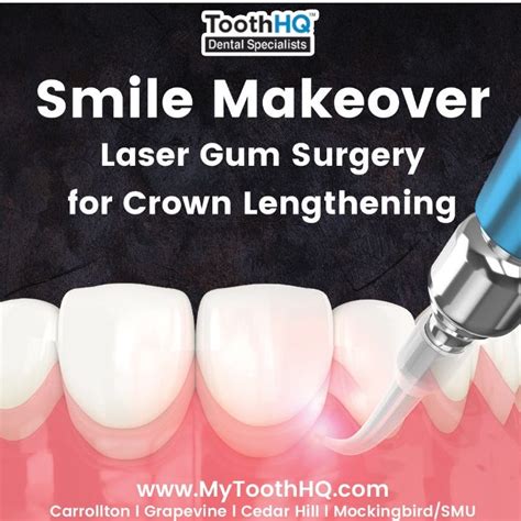 Crown Lengthening Made Easy With Laser Gum Surgery By Mytoothhq Medium