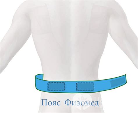 Лечение поясничного радикулита без врачей