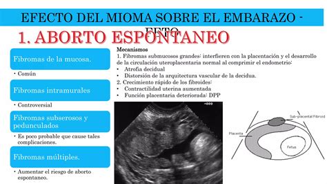 Miomas Uterinos Y El Embarazo Ppt