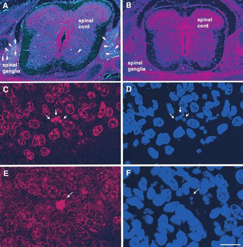 Caspase 3 Immunocytochemistry A B TUNEL C E And Bisbenzimide