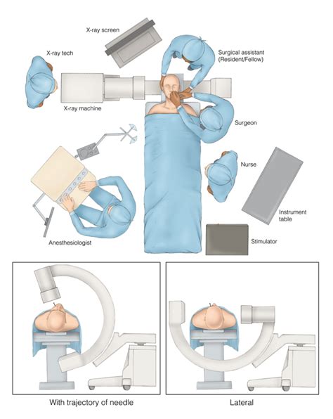 Trigeminal Neuralgia Expert Surgeon Aaron Cohen Gadol Md