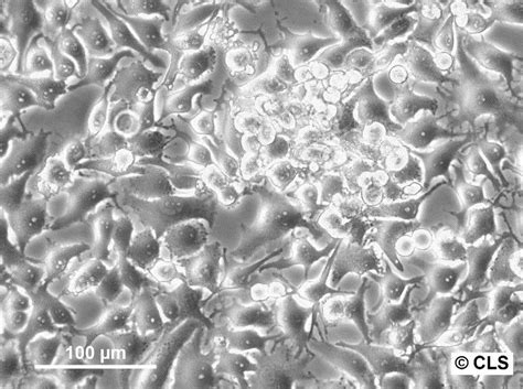 NCI H295R Cell Pellet 1 Million Cells Cell Pellet 1 Million Cells