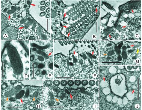 Transmission Electron Micrographs Showing The Cortical Ampule Like