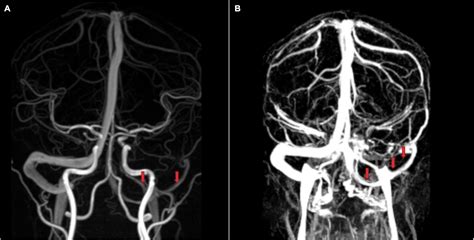 Frontiers Anatomy Imaging And Hemodynamics Research On The Cerebral