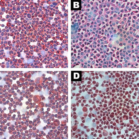 Photomicrographies Cytospins Of Uveal Melanoma Cell Lines A UW 1