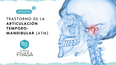 Qué es la Articulación Temporomandibular o ATM Clínica Fivasa