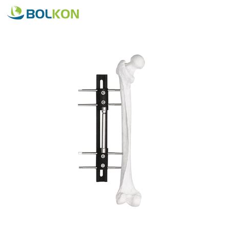 Bolkon Orthofix Type Bone Fracture External Fixator Elbow Joint Tibial