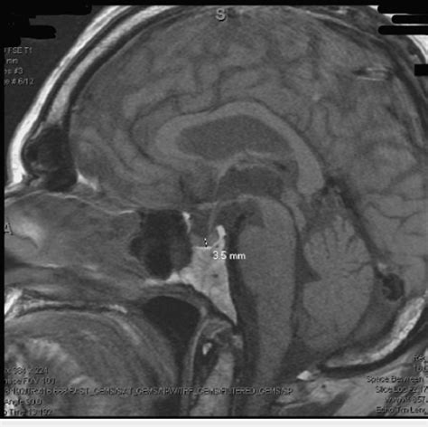 MRI of brain with contrast. | Download Scientific Diagram