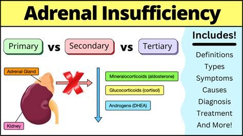 Adrenal Insufficiency Symptoms Causes Treatment Diagnosis Labs