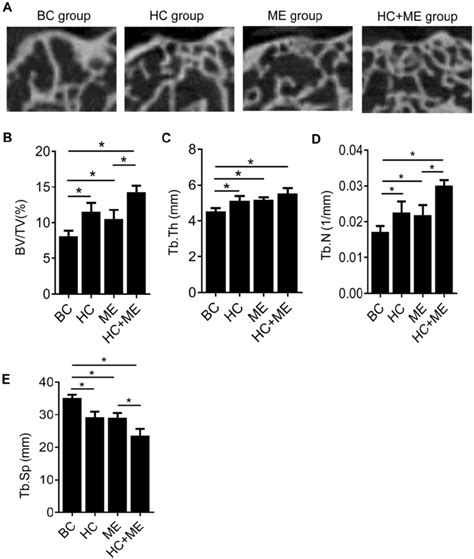 MicroCT Analysis Of The Subchondral Bone At The Injury Site And The