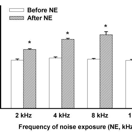 ABR Thresholds Of Auditory Brainstem Response Before And After Noise