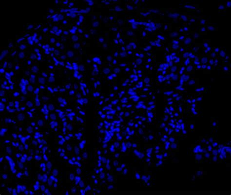 DAPI Staining | RTU DAPI Nuclear Stain Solution