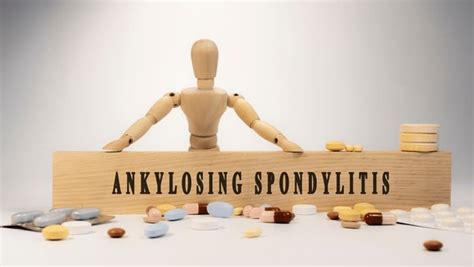 Ankylosing Spondylitis How Help Images Stock Photos D Objects